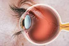 Retina Care